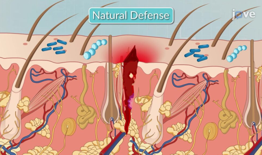 Natural defense mechanisms of the body